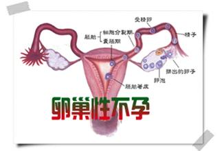 卵巢性不孕