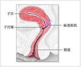 阴道解析图